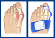 Big Toe Corrector - Flamin' Fitness